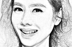 皮肤松弛法令纹明X怎么办 自体脂肪填充能维持多久