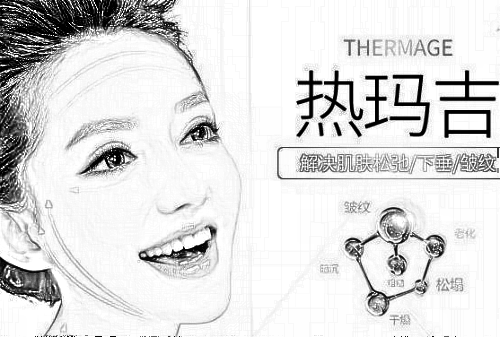 热玛吉的价格是多少 深受众多国内外大咖明星喜爱