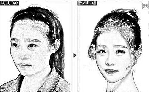 磨骨后手术明X吗 手术步骤是怎么样的