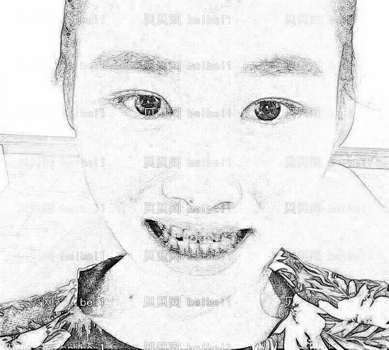 西安高一生医疗美容医院管锦荣矫正牙齿介绍