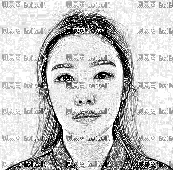 西安叶子医疗美容医院谢超全切双眼皮介绍