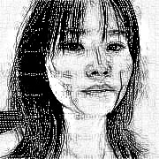 西安叶子医疗美容医院谢超面部吸脂介绍