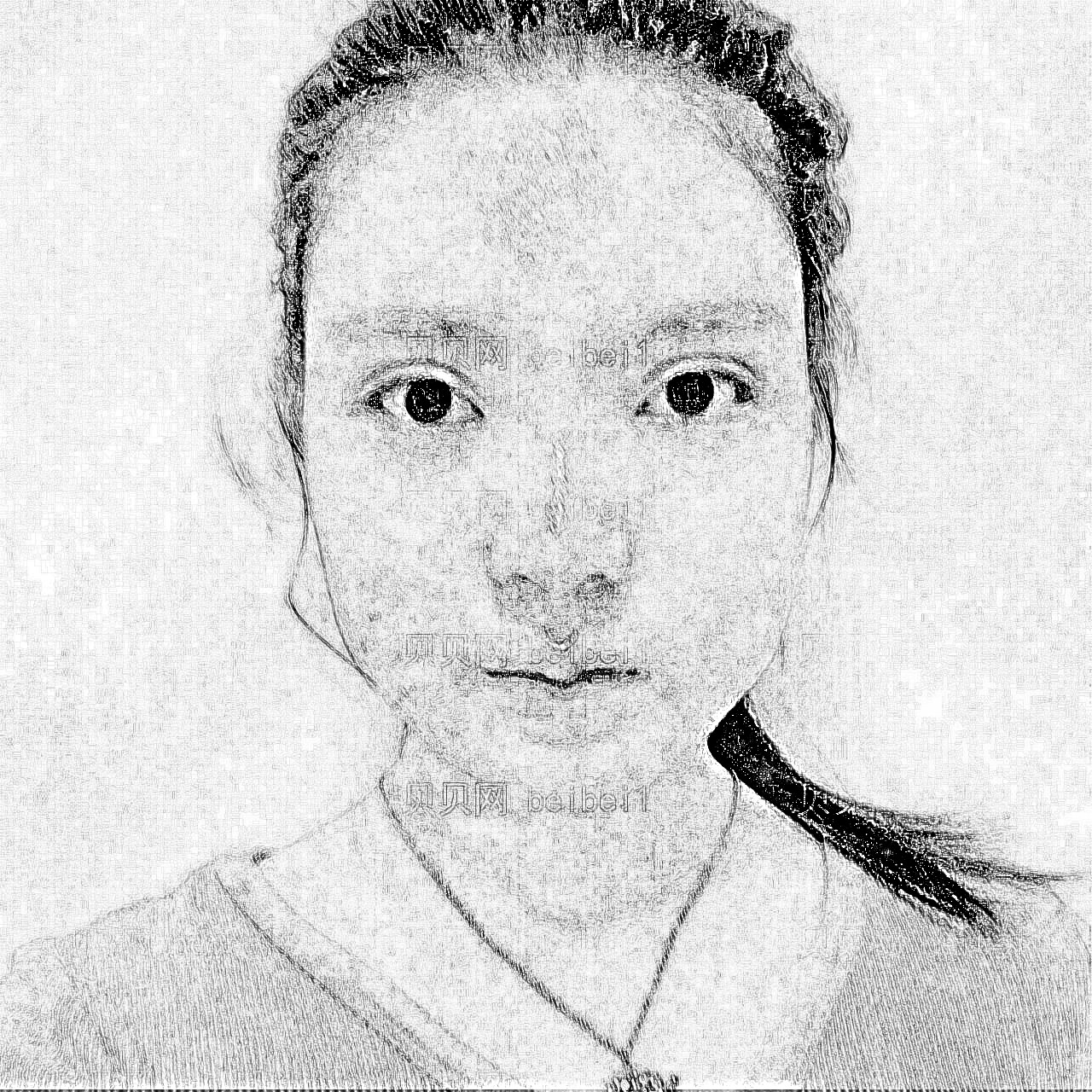 西安叶子医疗美容医院汪环脸部吸脂介绍
