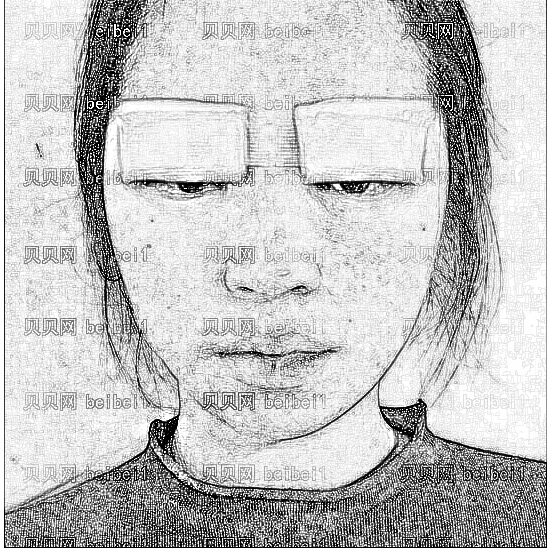 西安叶子医疗美容医院折涛切开双眼皮介绍