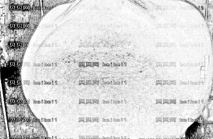 西安市第九医院整形美容科肖厚安祛疤介绍