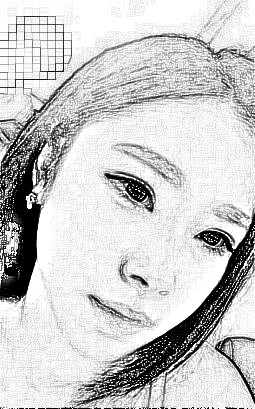 西安叶子医疗美容医院朱健康自体脂肪填充面部介绍