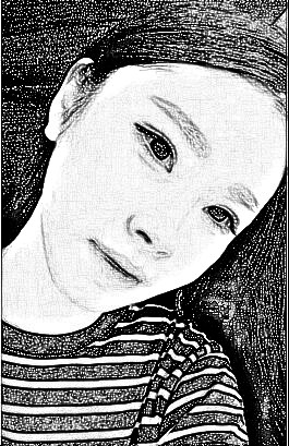 西安叶子医疗美容医院朱健康自体脂肪填充面部介绍