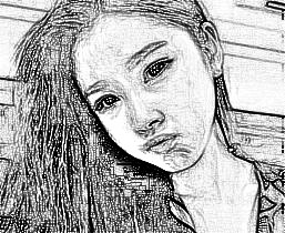 西安叶子医疗美容医院朱健康自体脂肪填充面部介绍