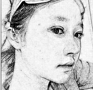 西安叶子医疗美容医院朱健康磨骨整形介绍