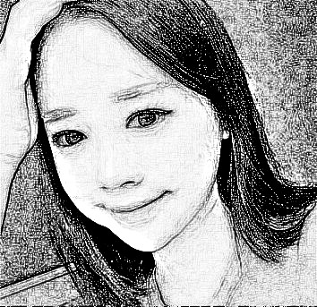 西安叶子医疗美容医院朱健康磨骨整形介绍