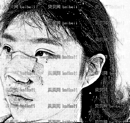 西安叶子医疗美容医院李明假体隆鼻介绍