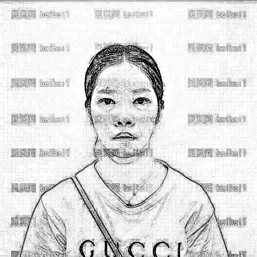 重庆华美整形医院刘冬阳玻尿酸填充面部介绍