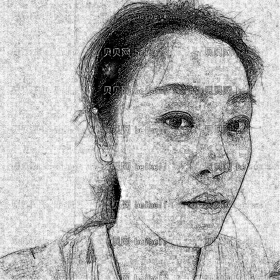重庆华美整形医院糜燕玻尿酸除皱介绍