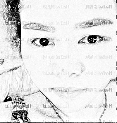 重庆华美整形医院邵雅娟激光祛斑介绍