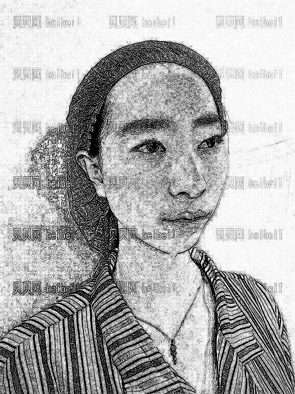 武汉一美整形美容医院汪利龙全切双眼皮介绍