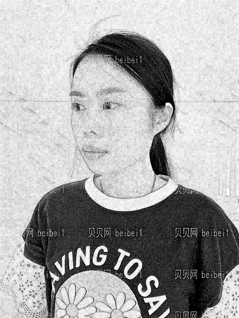 武汉壹加壹医疗美容医院王晓辉埋线双眼皮整形介绍
