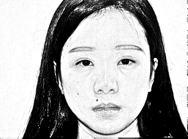 武汉壹加壹医疗美容医院叶素珍眼+鼻部手术整形介绍