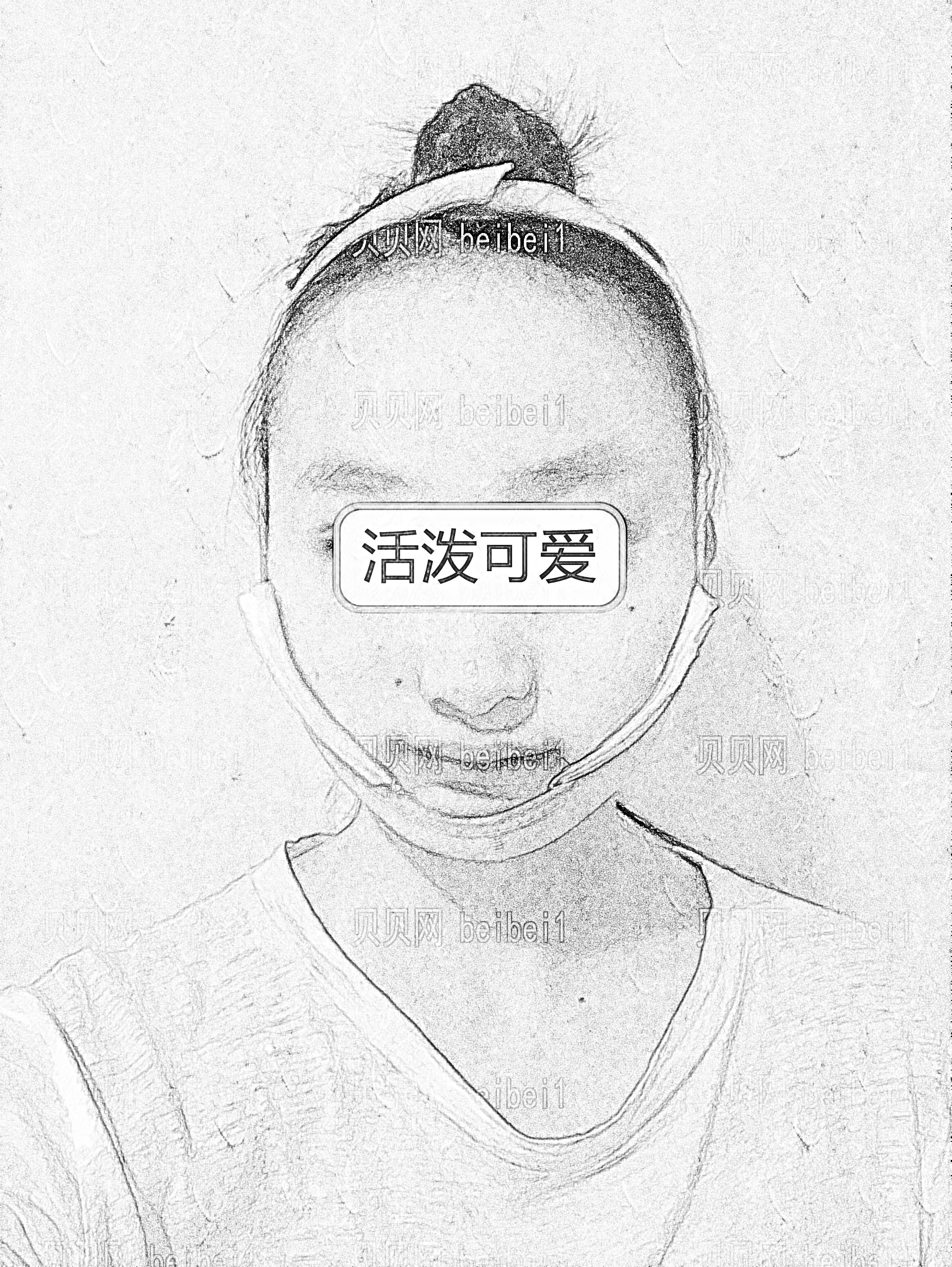武汉壹加壹医疗美容医院竺湘云下颌角整形介绍