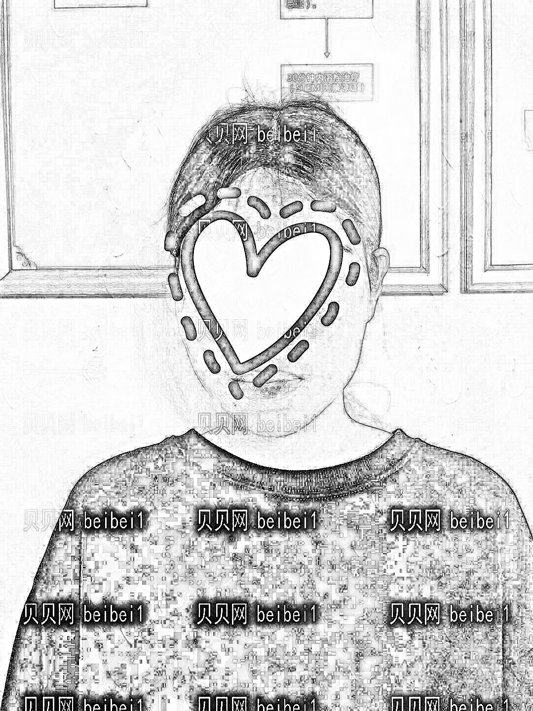 武汉壹加壹医疗美容医院李艳东自体脂肪脸部填充介绍