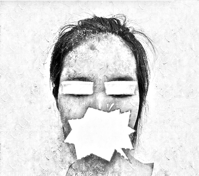 天津滨海医院整形美容中心崔海燕全切双眼皮介绍