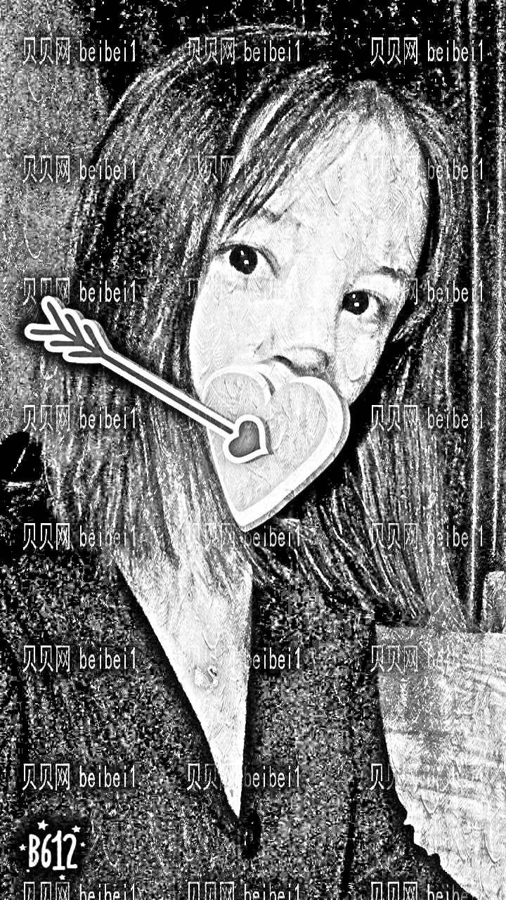 天津奥莉薇塔医疗美容门诊何栋梁垫鼻尖+假体隆鼻介绍