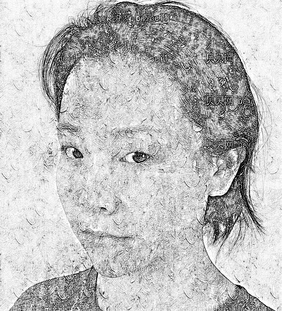 太原宏远爱谛医学美容门诊部郝睿鹏全切双眼皮介绍片较新分享_眼部的变化也给了我新的生活