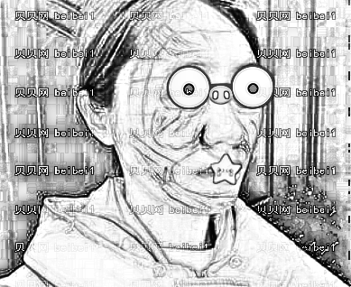 太原塑美整形美容门诊部樊娅娜自体脂肪面部填充介绍片较新分享_面填之后满满的胶原蛋白