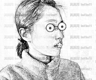 太原塑美整形美容门诊部樊娅娜自体脂肪面部填充介绍片较新分享_面填之后满满的胶原蛋白
