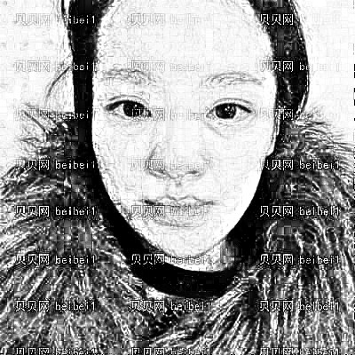 西安丽樽医疗整形美容赵东升鼻整形（假体）介绍片较新分享_隆鼻后天天都开森了很多