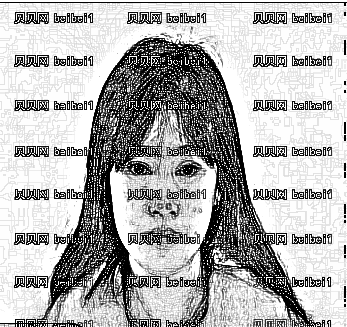 西安丽樽医疗整形美容吉燕假体隆鼻介绍片较新分享_气质变高了不少!