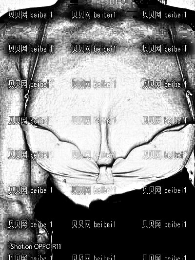 西安艺星医疗美容医院罗盛康假体隆胸介绍片较新分享_运动起来胸部也很动感的啦