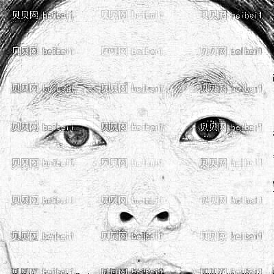 西安交通大学第(一)附属医院整形外科白转丽切开双眼皮介绍片较新分享_双眼皮后变得了更加美丽和自信