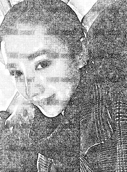 西安瑞丽整形美容医院郭永华鼻部手术整形介绍片较新分享_郭医生做的鼻子果出乎了我意料,哈哈!