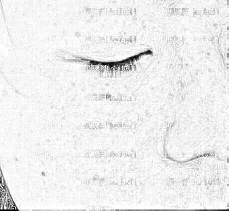 西安晶肤皮肤美容门诊部黄海燕祛斑介绍片较新分享_脸部肌肤柔嫩,看上去很干净了哦