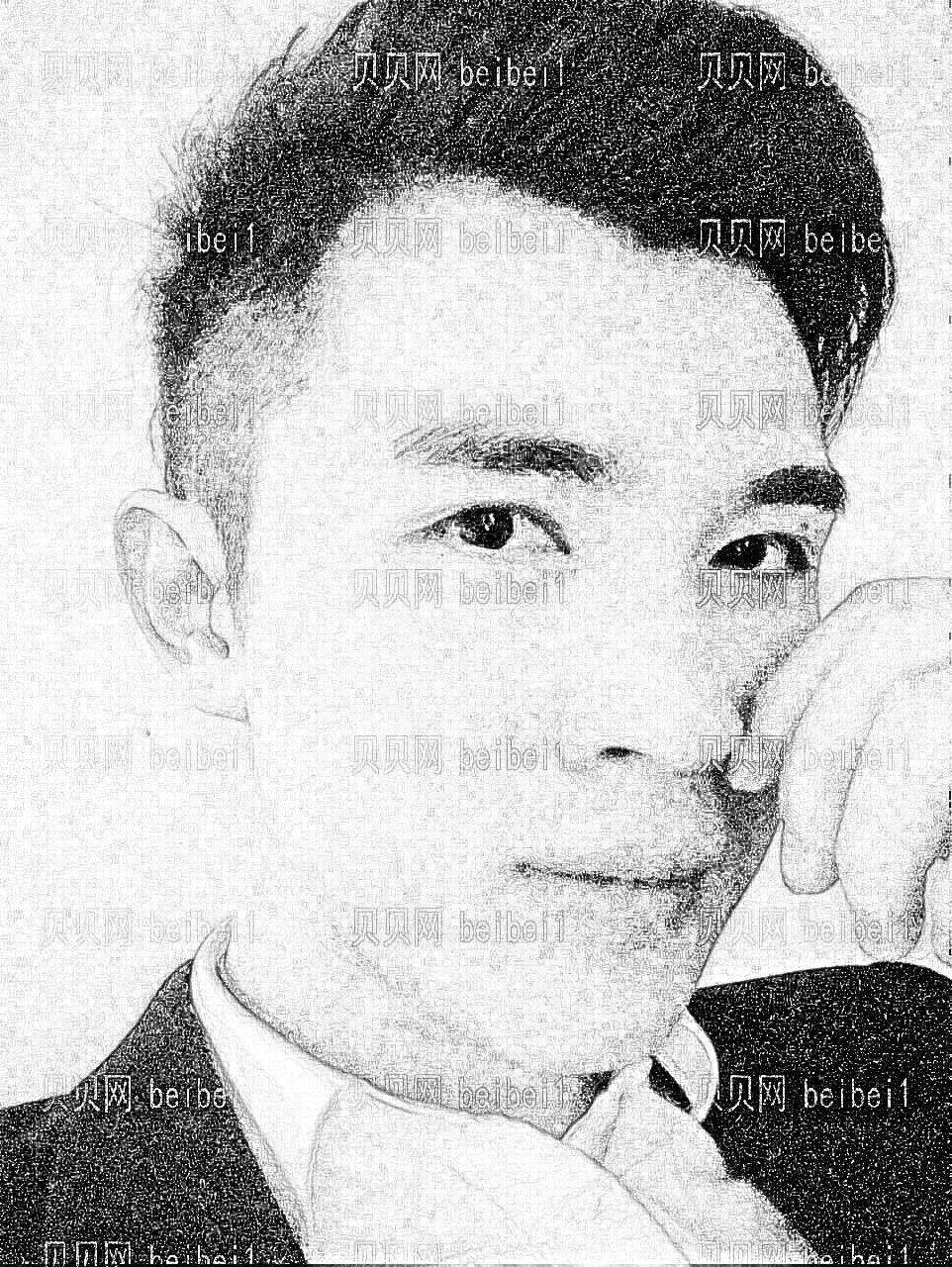 西安晶肤皮肤美容门诊部马爱红玻尿酸丰额头介绍片较新分享_面部仍然很饱满,够英俊吧!