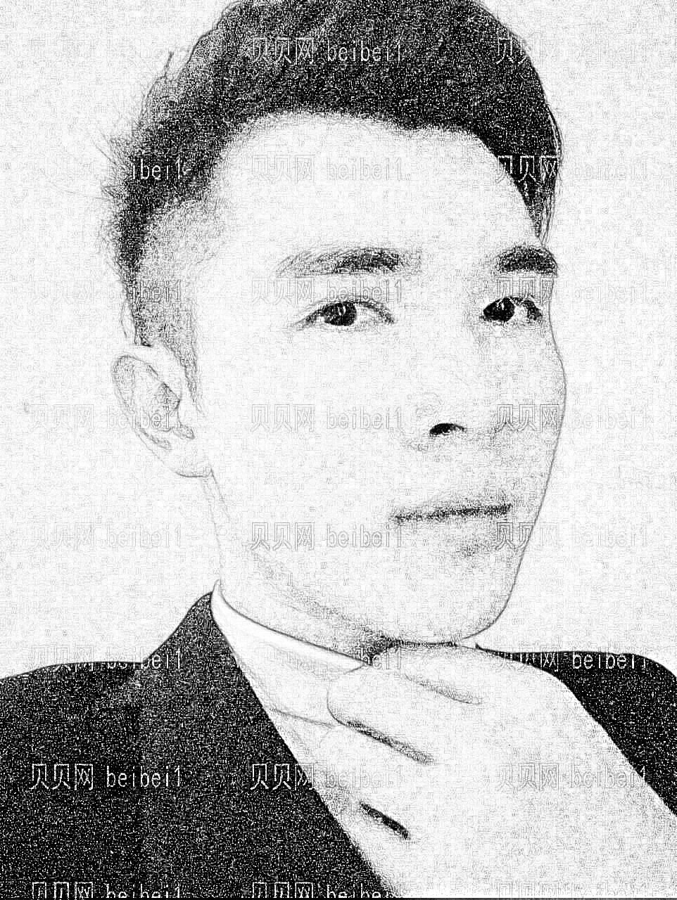 西安晶肤皮肤美容门诊部马爱红玻尿酸丰额头介绍片较新分享_面部仍然很饱满,够英俊吧!