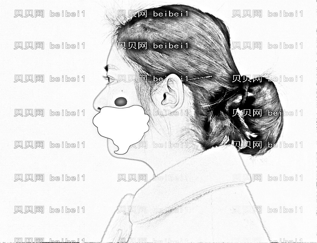 西安美立方医疗美容医院闫淑医师双眼皮+开眼角介绍片较新分享_只要不盲目的选择，双眼皮还是很容易拥有滴！