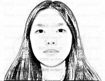 西安美立方医疗美容医院杨占风玻尿酸丰下巴介绍片较新分享_下巴好看了，我也变得开朗了哦~