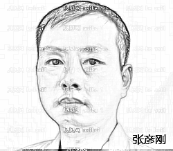 西安西美整形外科中心张彦刚耳软骨隆鼻介绍片较新分享_线条以及弧度流畅,就像自己的鼻子一样