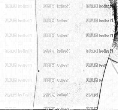 西京医院整形科李荟元臂部疤痕修复介绍片较新分享_颜值也因疤痕的消失而提高了!
