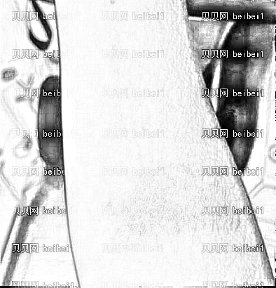 西京医院整形科李荟元臂部疤痕修复介绍片较新分享_颜值也因疤痕的消失而提高了!