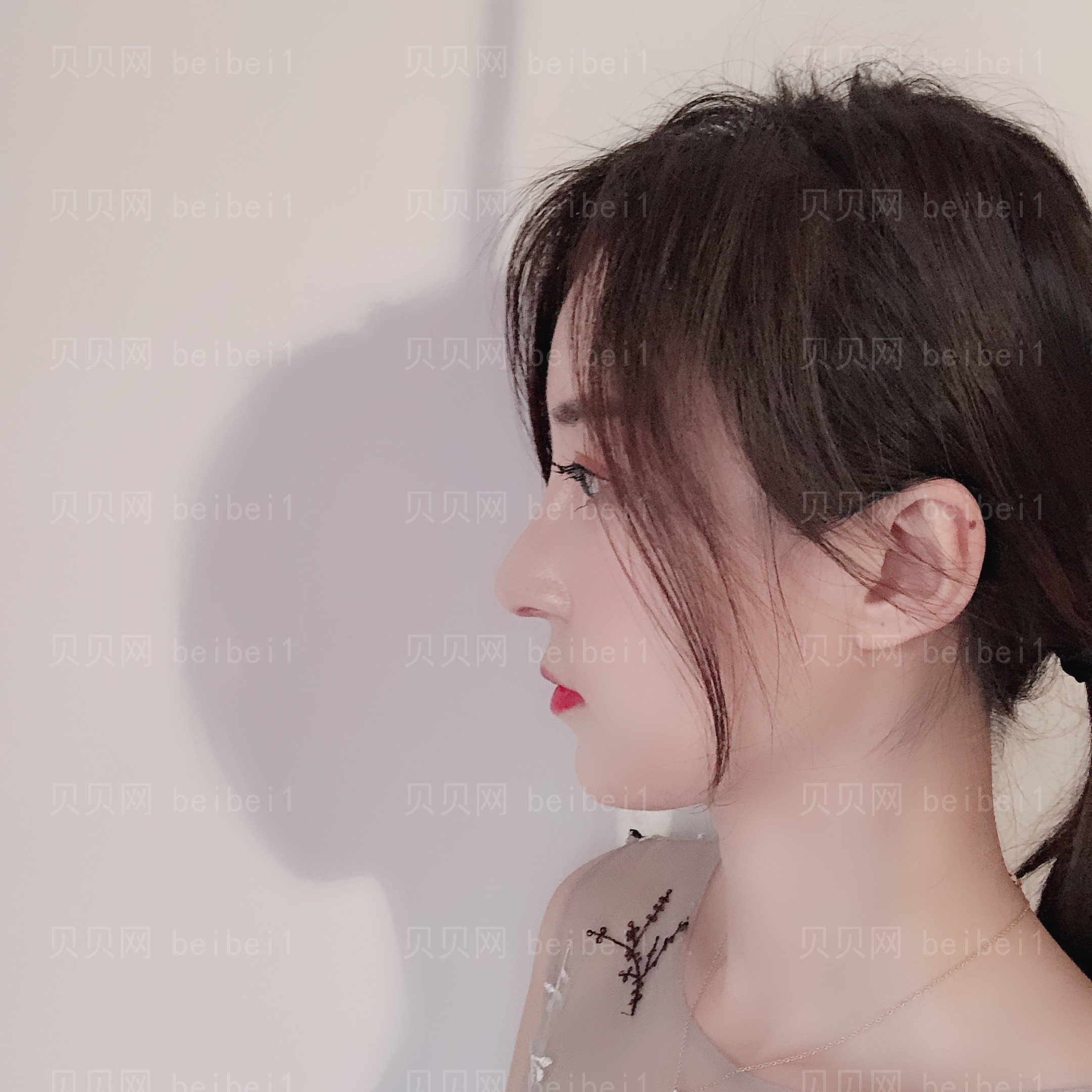 西京医院整形科彭湃注射隆鼻介绍片较新分享_美鼻给颜值加了不少分,还提升了气质呢!