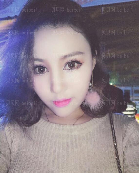 西京医院整形科彭湃切开双眼皮介绍片较新分享_眼睛恢复得毫无违和感了咯!