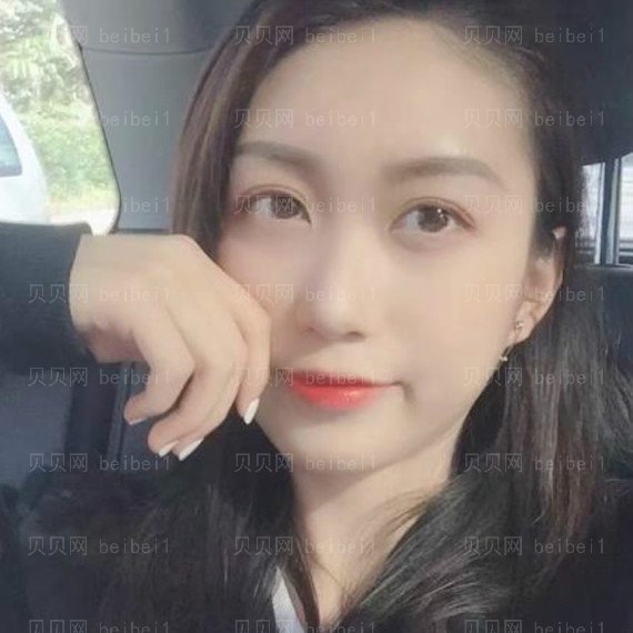 西京医院整形科宋保强全切双眼皮介绍片较新分享_分享下美照给大家养养眼吧~~~漂亮否?