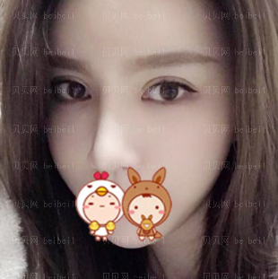 西京医院整形科宋保强鼻部手术整形介绍片较新分享_独特的美鼻,有让我更具个性了!
