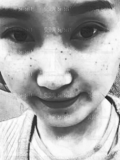 西京医院整形科樊星光子嫩肤介绍片较新分享_皮肤都变得白皙、嫩滑了哦！