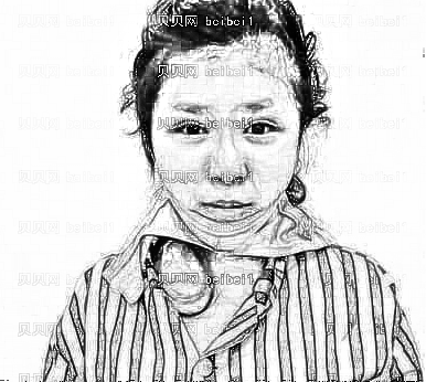 太原花妍年华医疗美容门诊部李永生下颌角整形介绍片较新分享_脸越来越精致,我也有了瓜子脸哦
