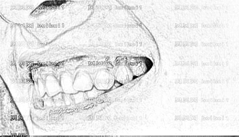 太原时光整形美容医院白丽鹏矫正牙齿案例图片较新分享_牙齿患者反馈日记