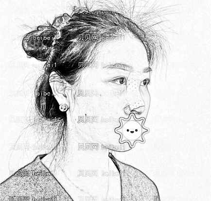 天津菲丝澜医疗美容谢彦雄鼻综合案例图片最新分享_新鼻子的感觉真好！