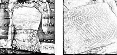 天津菲丝澜医疗美容党涛隆胸介绍片较新分享_1个多月鼻子就比较自然啦,看下怎么样吧!